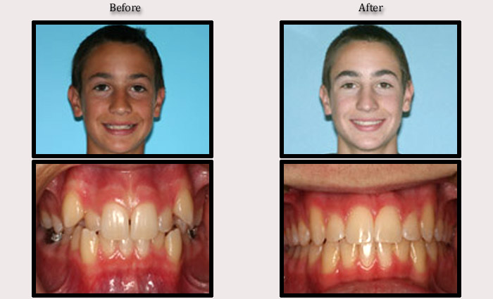 Case 4