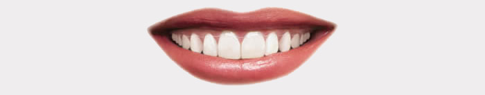 Invisalign